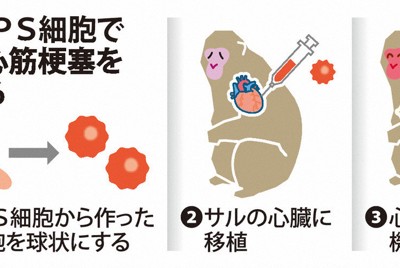 ヒトiPS細胞でサルの心機能回復　心筋梗塞の治療に道　信州大