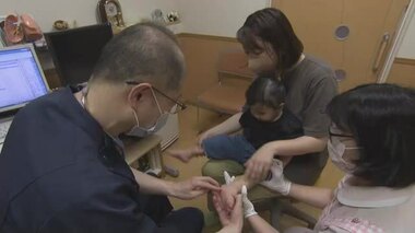 治っても再び感染…「手足口病」が全国的に流行　岡山県は過去１０年で最多　香川県では警報発令中