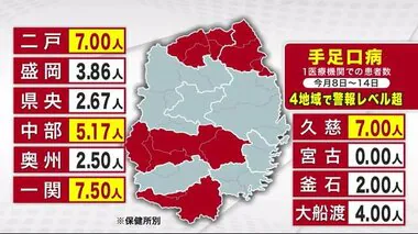 「手足口病」岩手県内の患者数が前週比３倍に　４つの地域で警報基準超