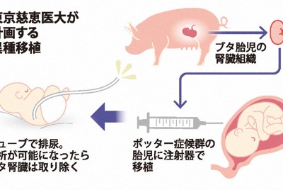 国内初の「異種移植」へ　ブタの腎組織を腎臓病の胎児に　慈恵医大