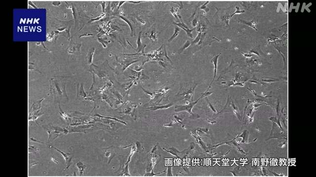 「老化細胞」を薬で取り除く臨床研究 順天堂大など学内申請へ