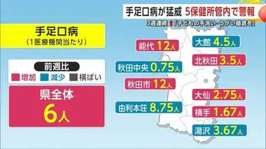 「手足口病」が猛威、3週連続で患者数増加　5保健所管内に警報　子どもの手洗い・うがい徹底を　秋田