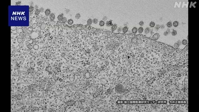 鳥インフル 牛からヒトに感染後で性質など変化か 東大など発表