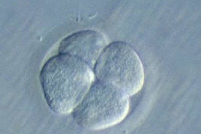 ゲノム編集したヒト胚を胎内に戻す移植を禁止　国内初の法規制へ